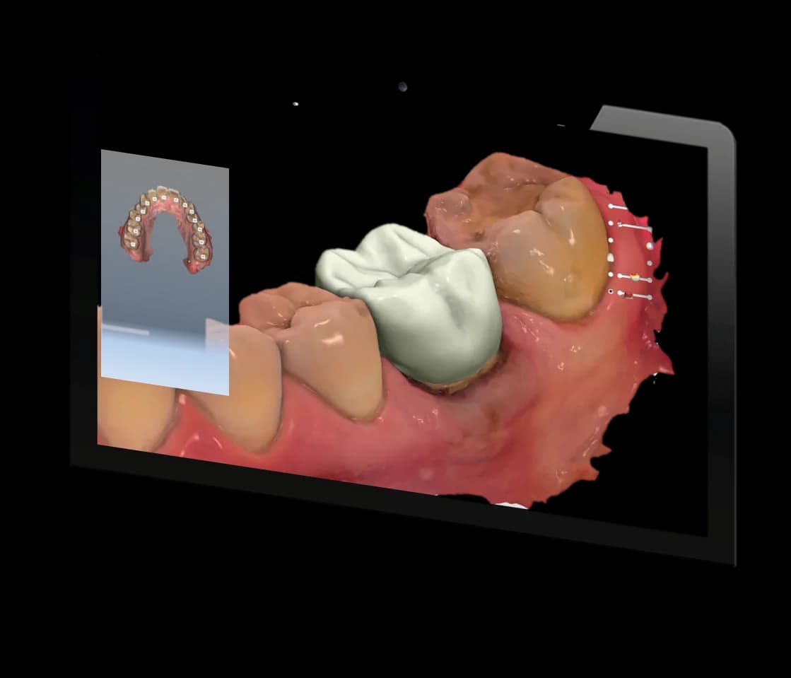 Digital Milling Process