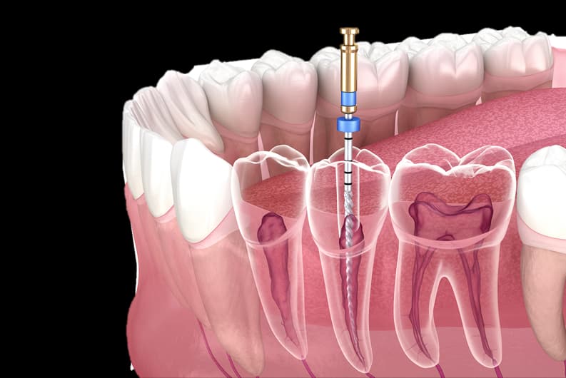 Emergency Dental Treatment