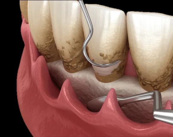 Pregnancy Dental Care