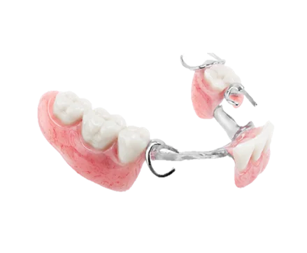 Dentures in Hyderabad - Noble Dental Care