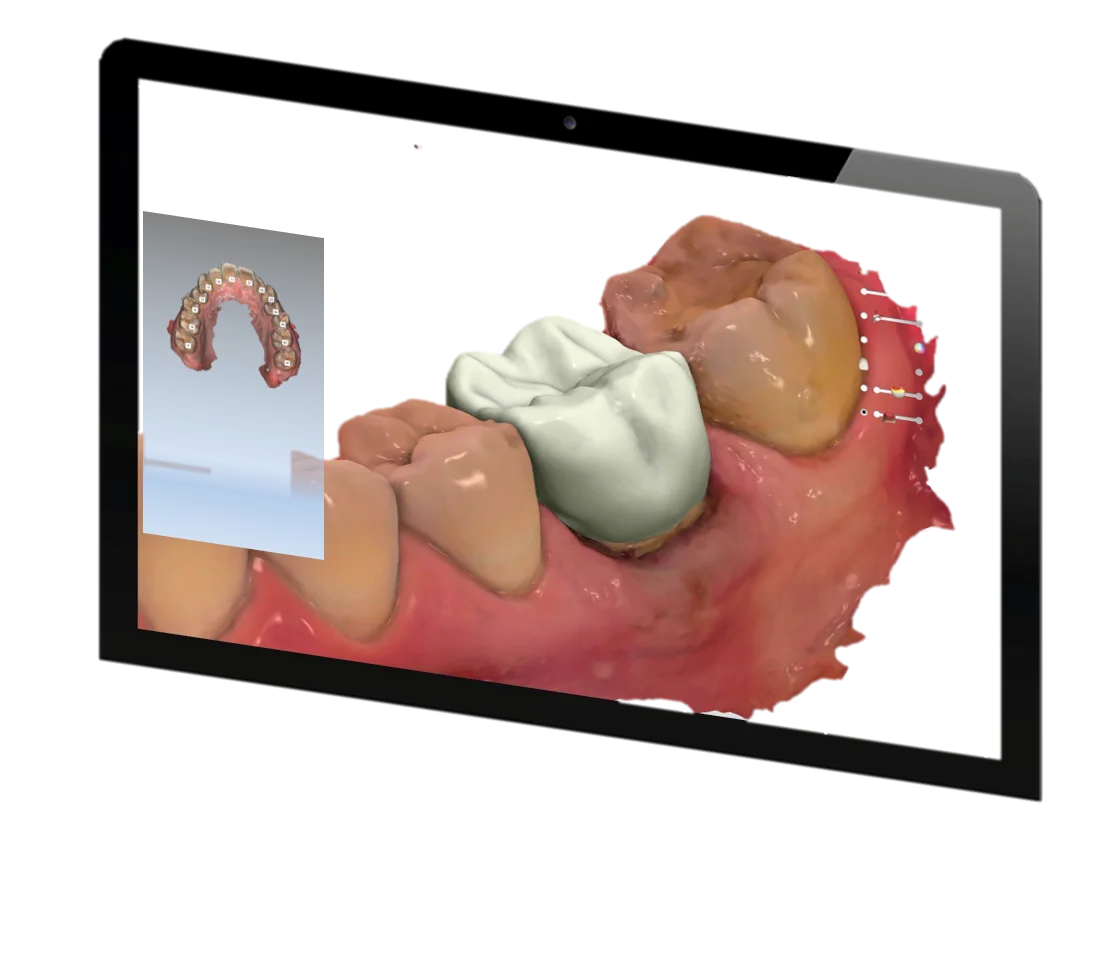 Digital Dentistry in Hyderabad - Noble Dental Care