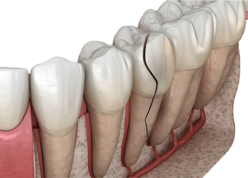 Emergency Dentistry in Hyderabad - Noble Dental Care