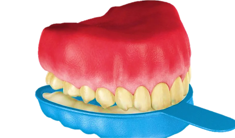 Fluoride Therapy in Hyderabad - Noble Dental Care