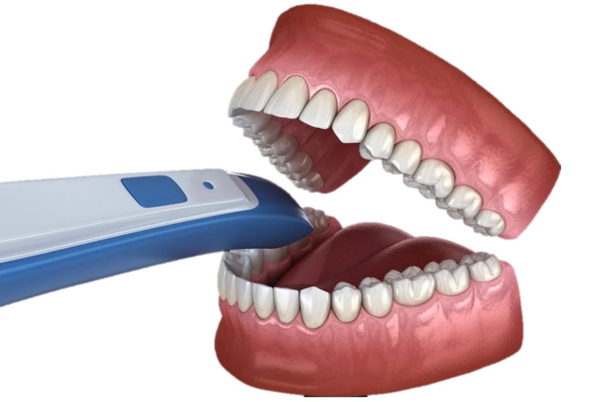 Intraoral 3D Dental Scans in Hyderabad - Noble Dental Care