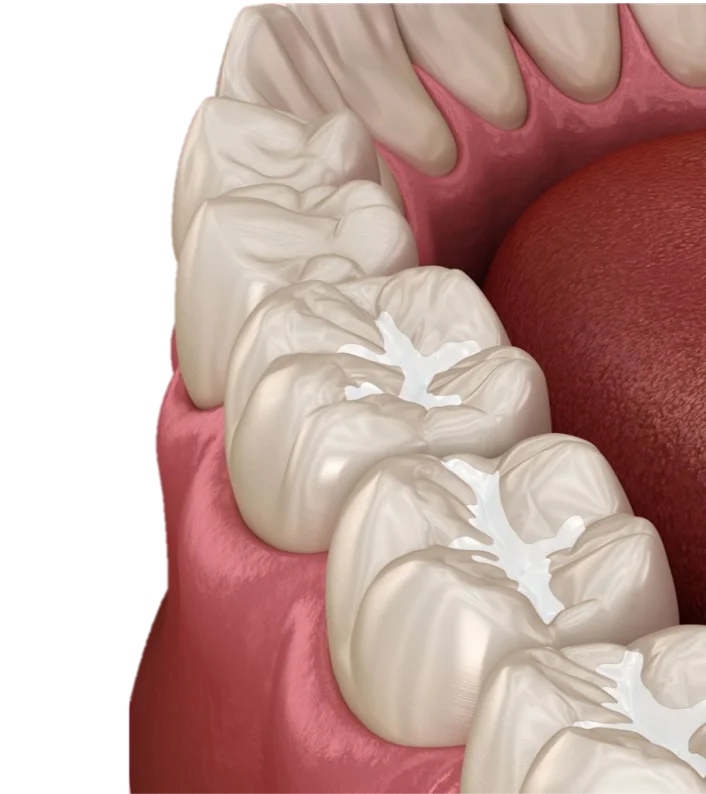 Preventive Dentistry in Hyderabad - Noble Dental Care
