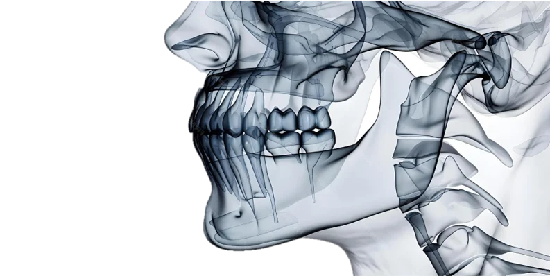 TMJ Disorder Treatment in Hyderabad - Noble Dental Care
