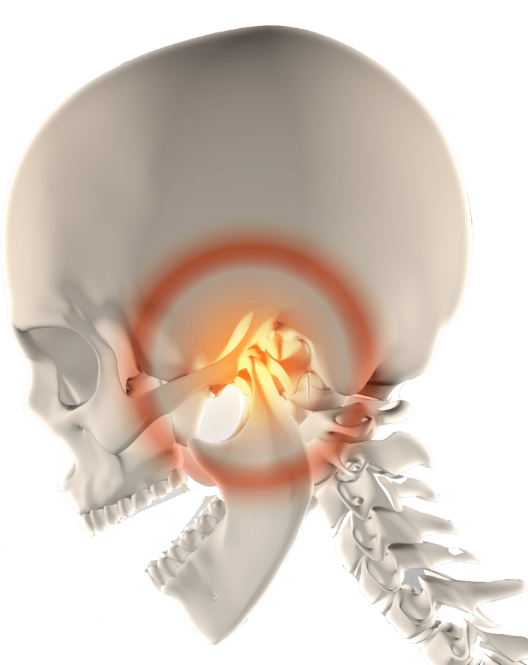 TMJ and TMD Jaw Therapy in Hyderabad - Noble Dental Care